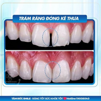 tramrang