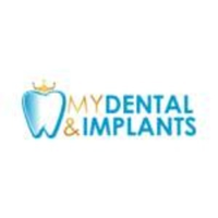 mydentalmplants